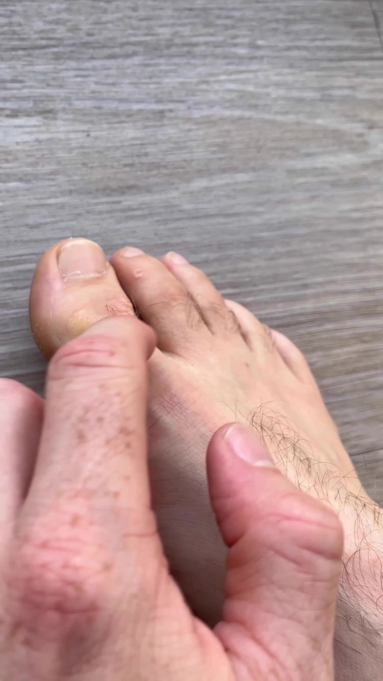 Hautpflege Video von Marcel  für Summer Foot