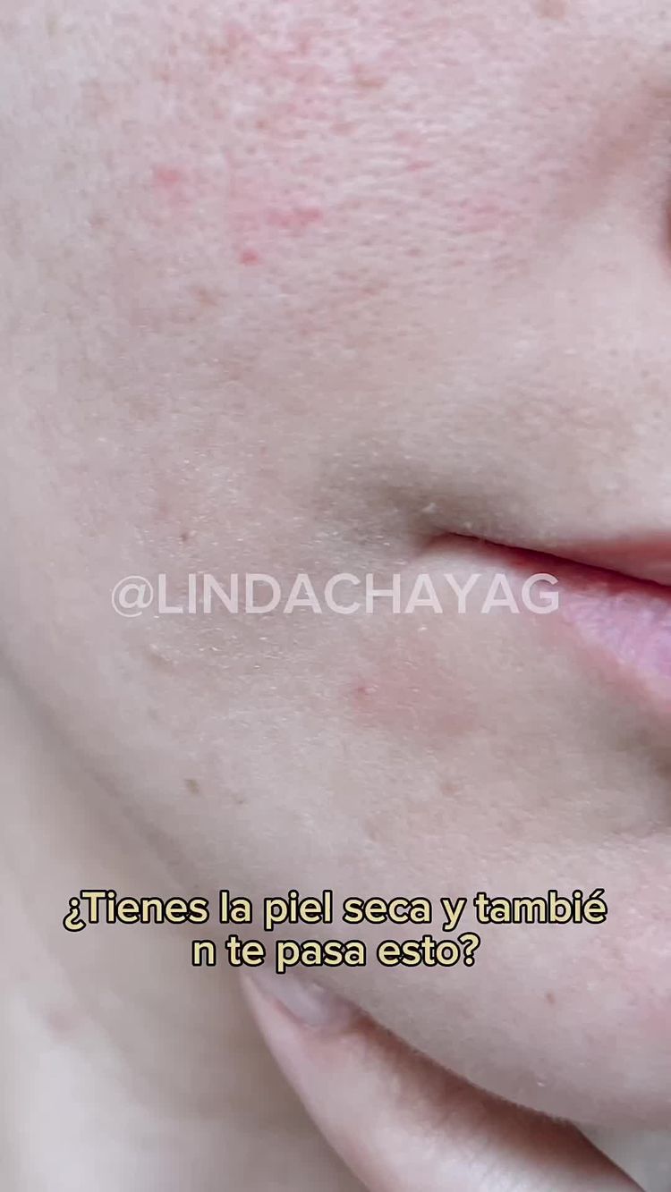 Video di Linda